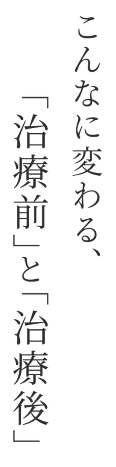 こんなに変わる、「治療前」と「治療後」